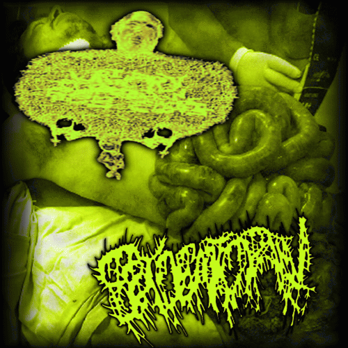 Epidemic Pain : Urinary Tract Infection from Severe Pus Clots - Epidemic Pain